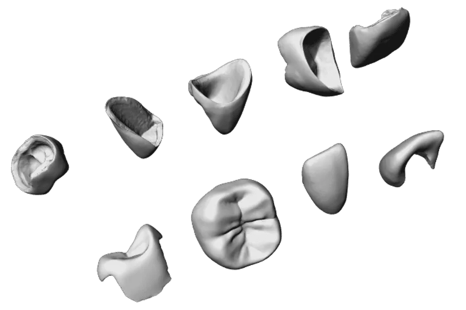 Crowns in CAD