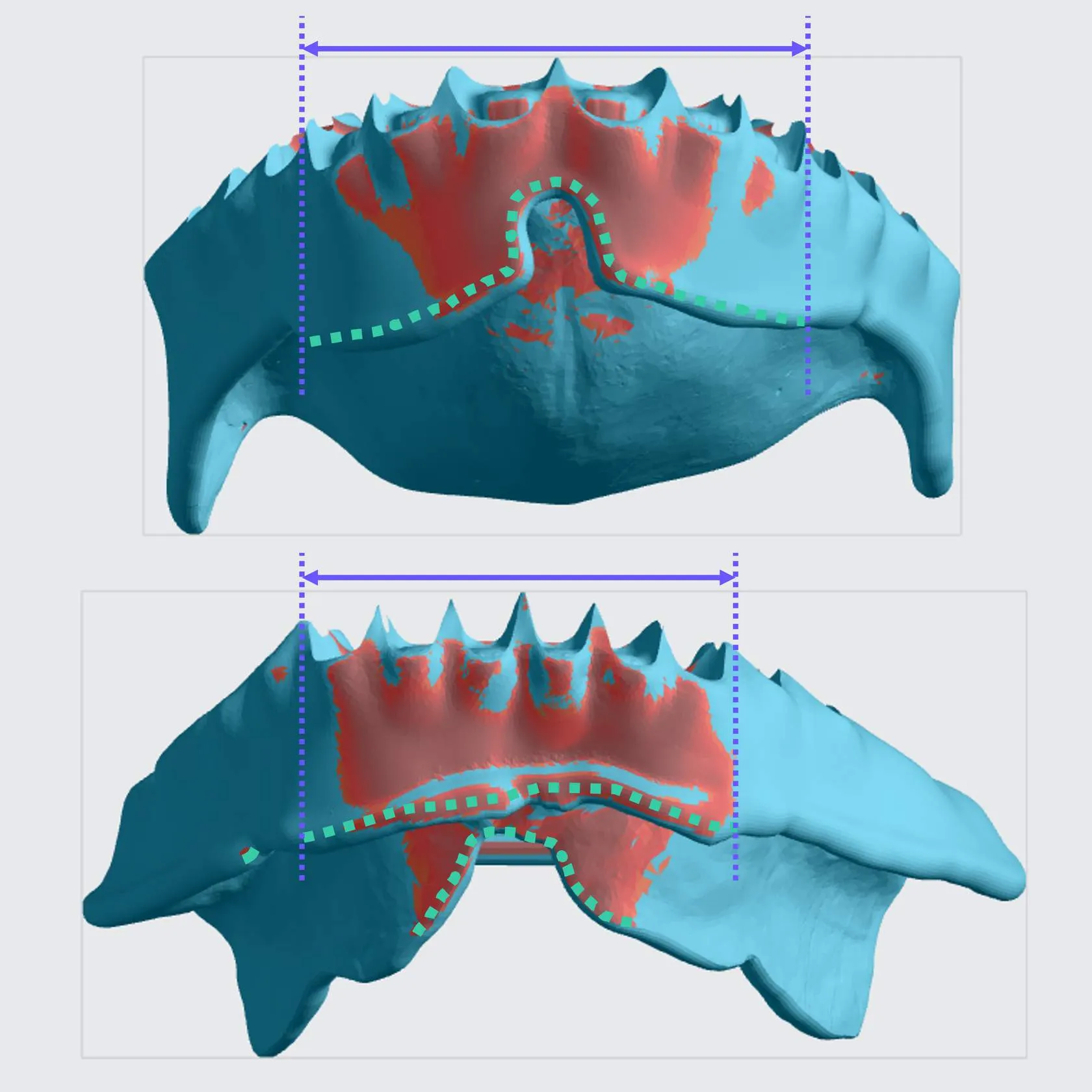 Denture Base Supports Goal Denture Base Supports Goal