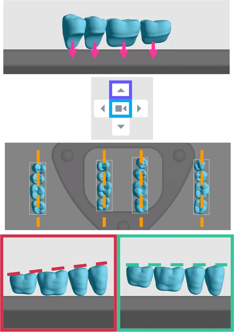 Orientation of tooth models Orientation of tooth models