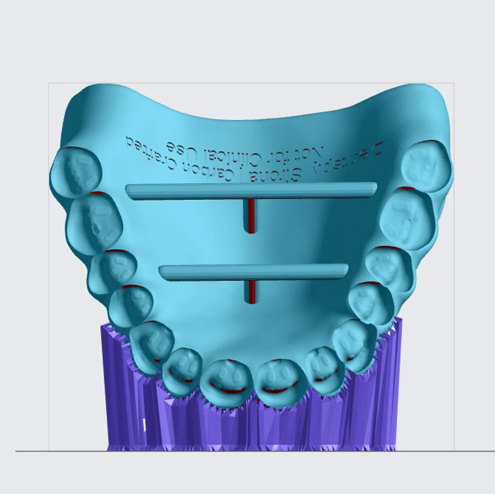 Upper Denture (front view) Upper Denture (front view)