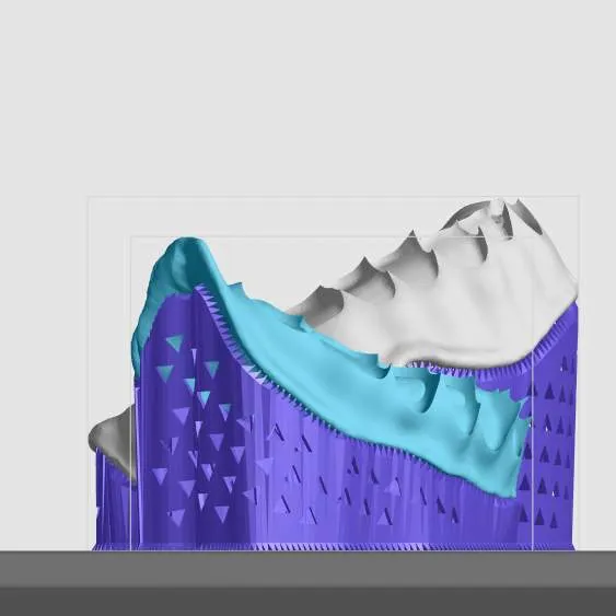 Well supported mandibular base