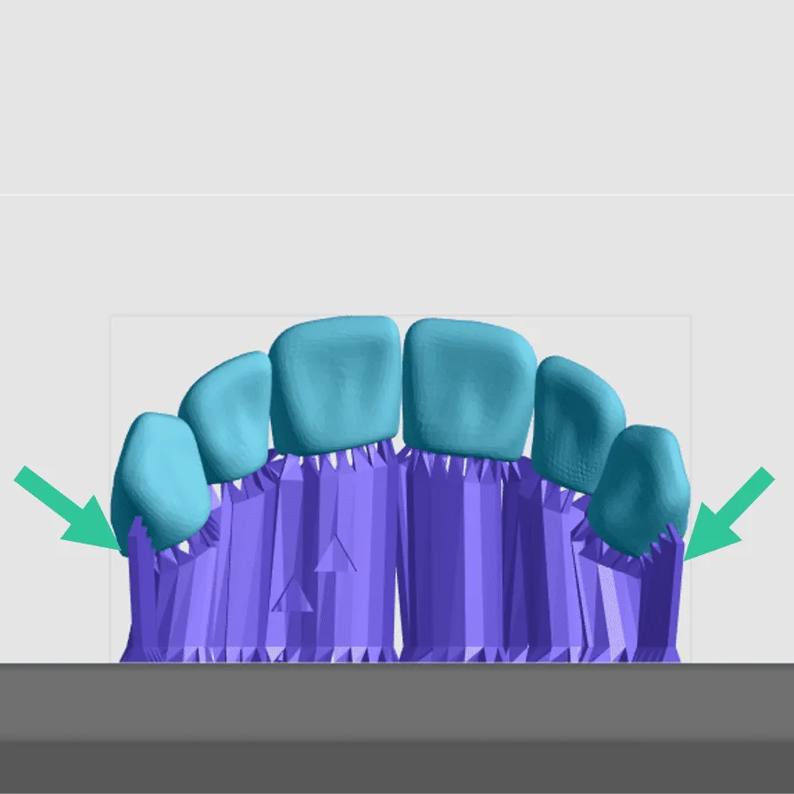 Properly supported anterior teeth block Properly supported anterior teeth block
