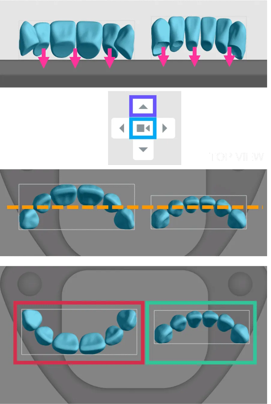 Orientation of tooth models Orientation of tooth models