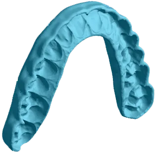 Example splint model