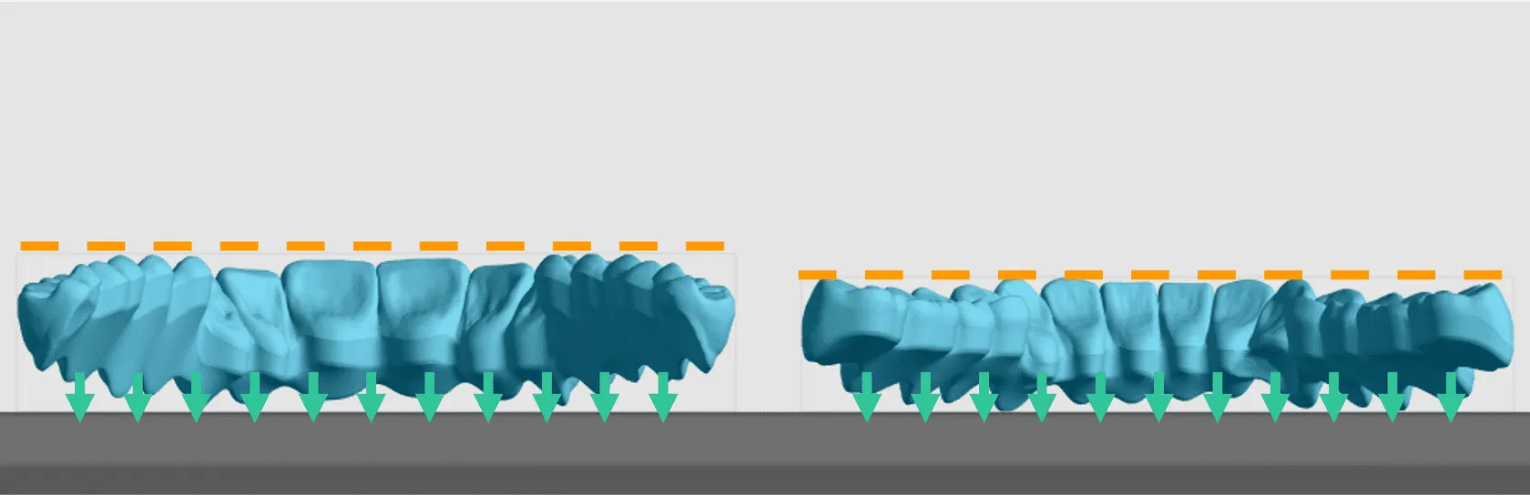 Orientation of full arches Orientation of full arches