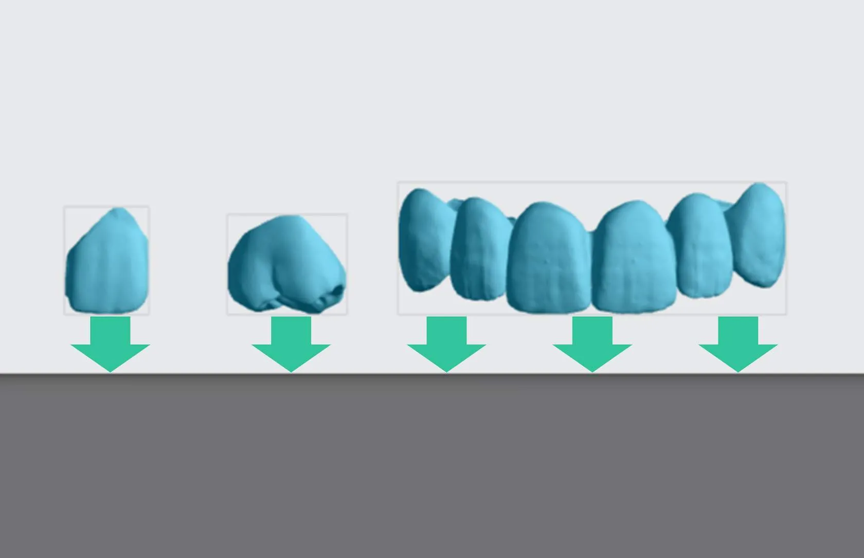 Occlusal surfaces face platform Occlusal surfaces face platform