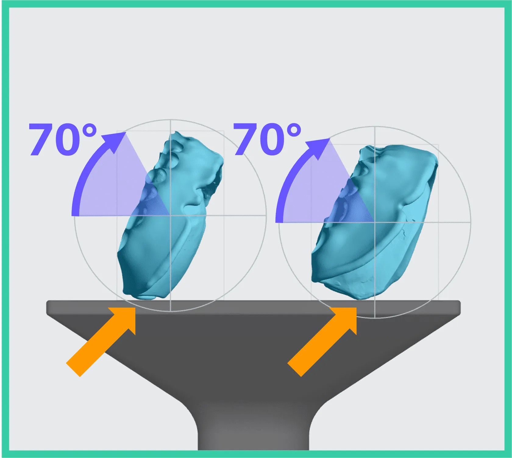 Lower and Upper Denture Bases Lower and Upper Denture Bases