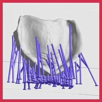 Poor supports generated by Auto Support feature