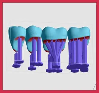 Poor supports generated by Auto Support feature Poor supports generated by Auto Support feature