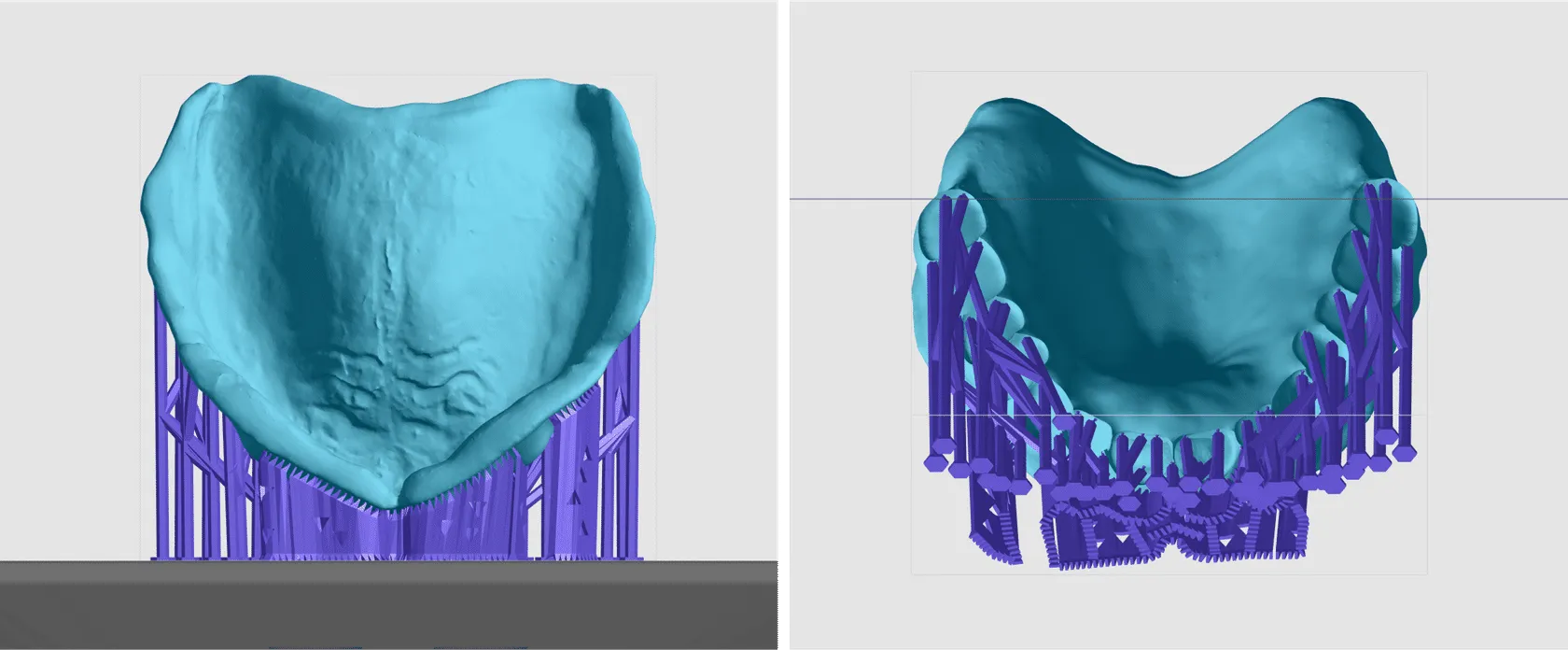 Well supported near vertical base