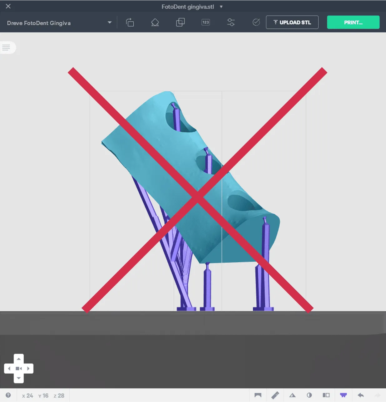 Example of gingiva model wrongly oriented at an angle from platform required supports. Example of gingiva model wrongly oriented at an angle from platform required supports.