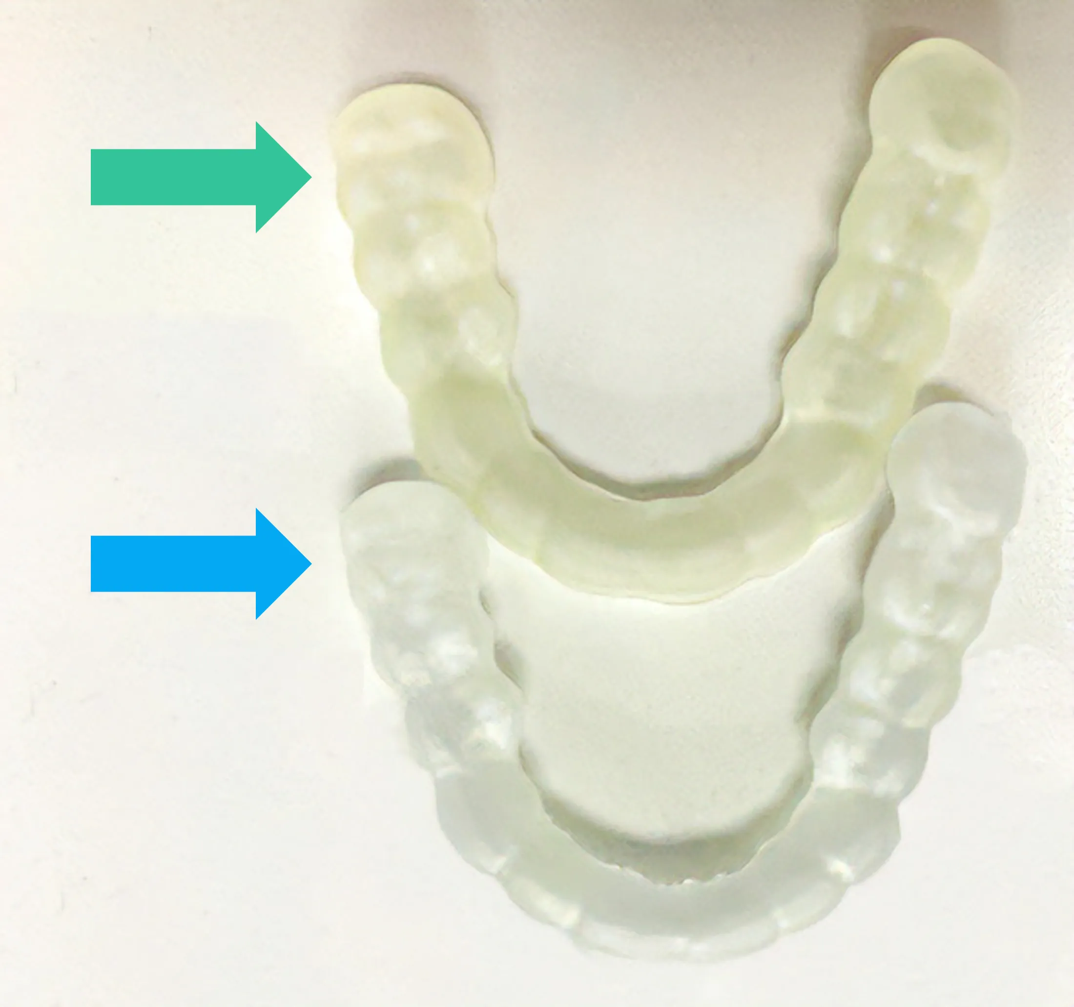 Yellowing of splints