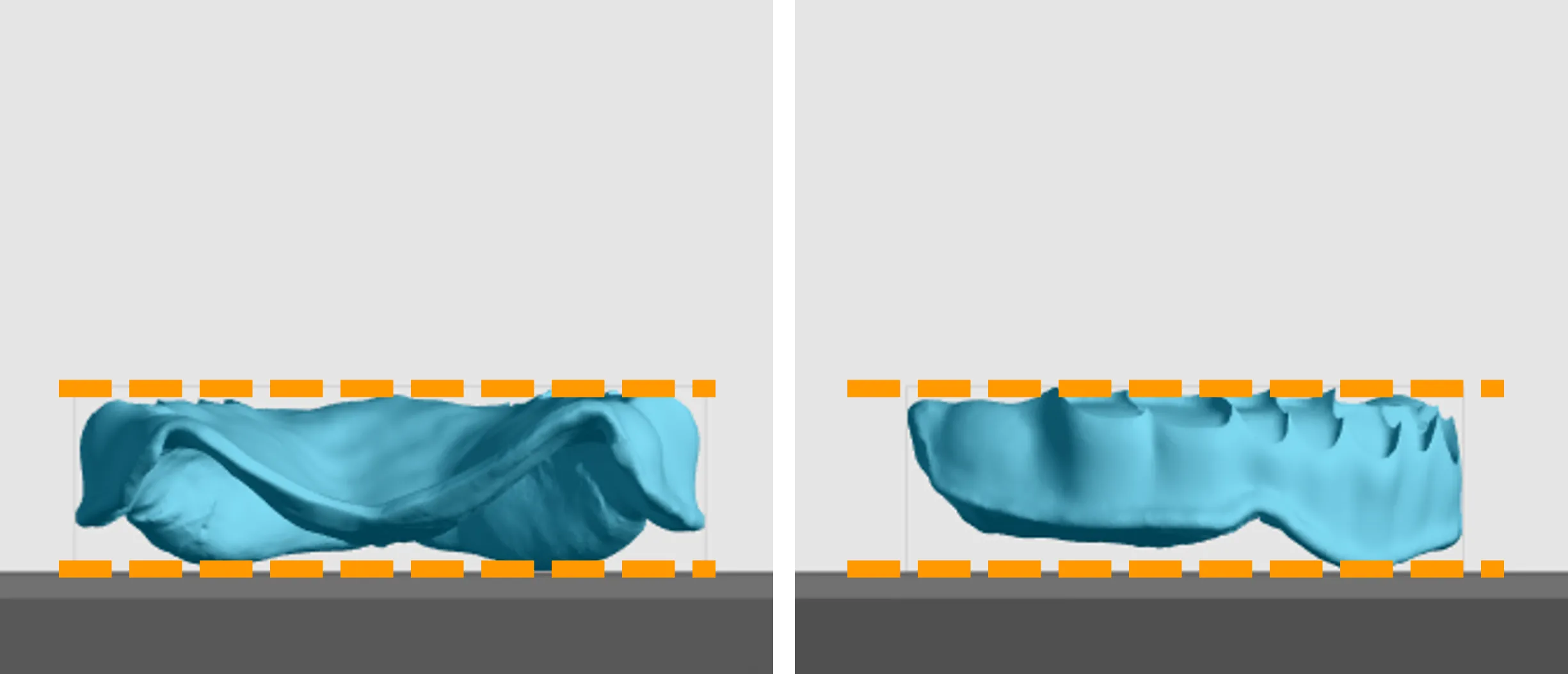 Parallel orientation
