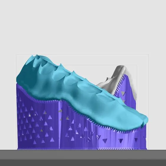 Well supported maxillary base