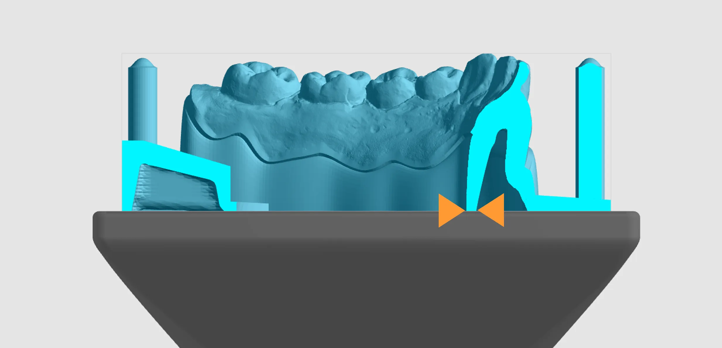 Section through mandibular model Section through mandibular model