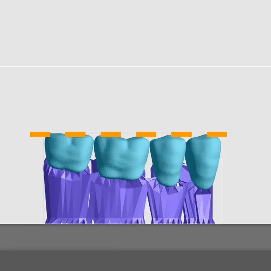 Properly supported posterior teeth block Properly supported posterior teeth block