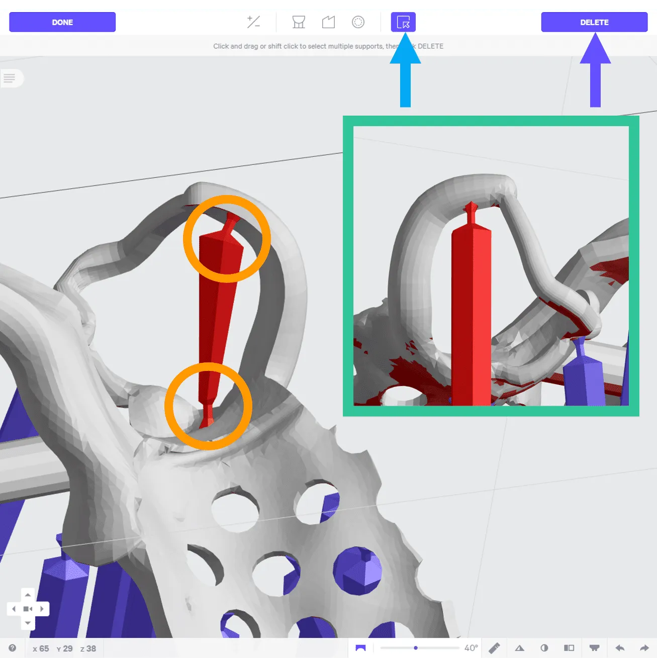 Remove supports inside clasps Remove supports inside clasps