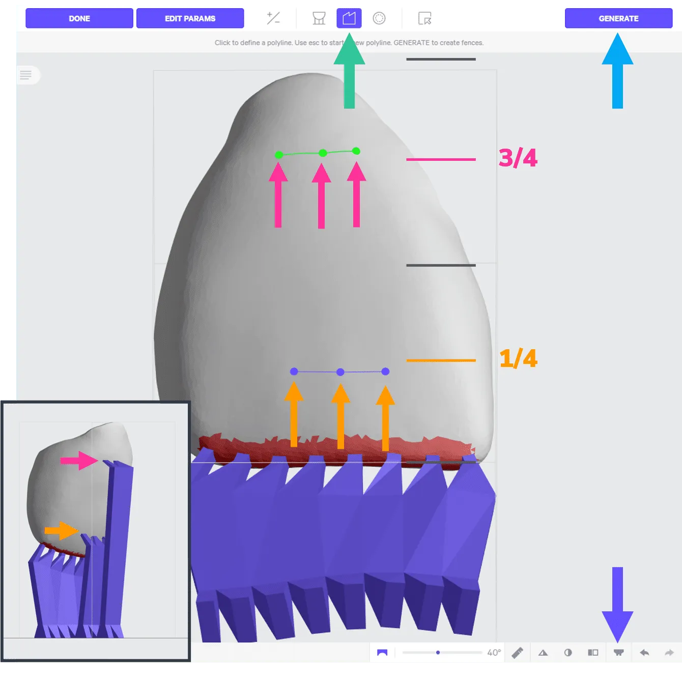 Supporting incisor Supporting incisor