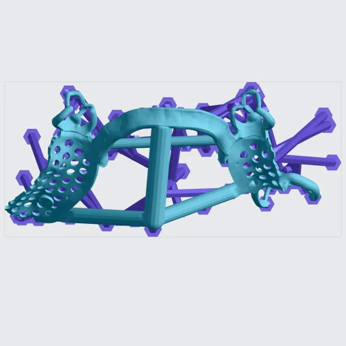 Top view of properly supported partial Top view of properly supported partial