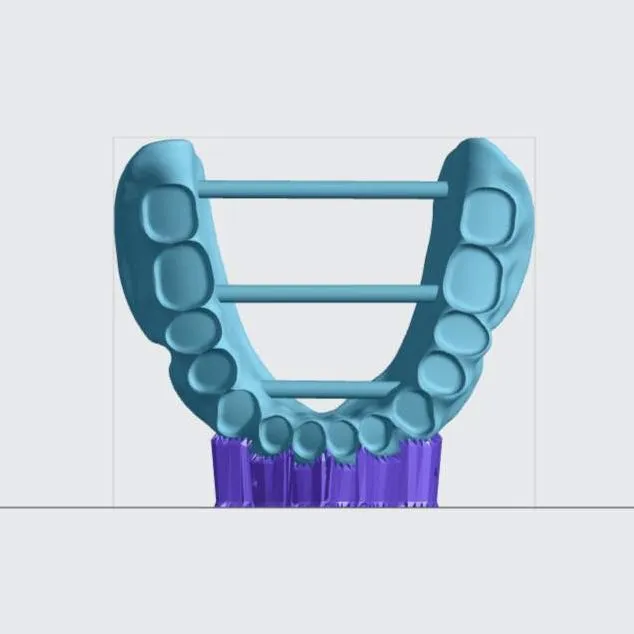 Lower denture (front view) Lower denture (front view)
