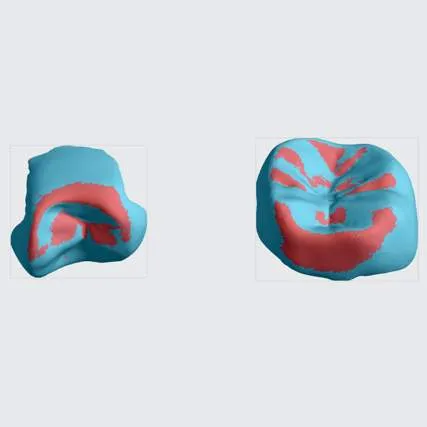 Bottom View Bottom View