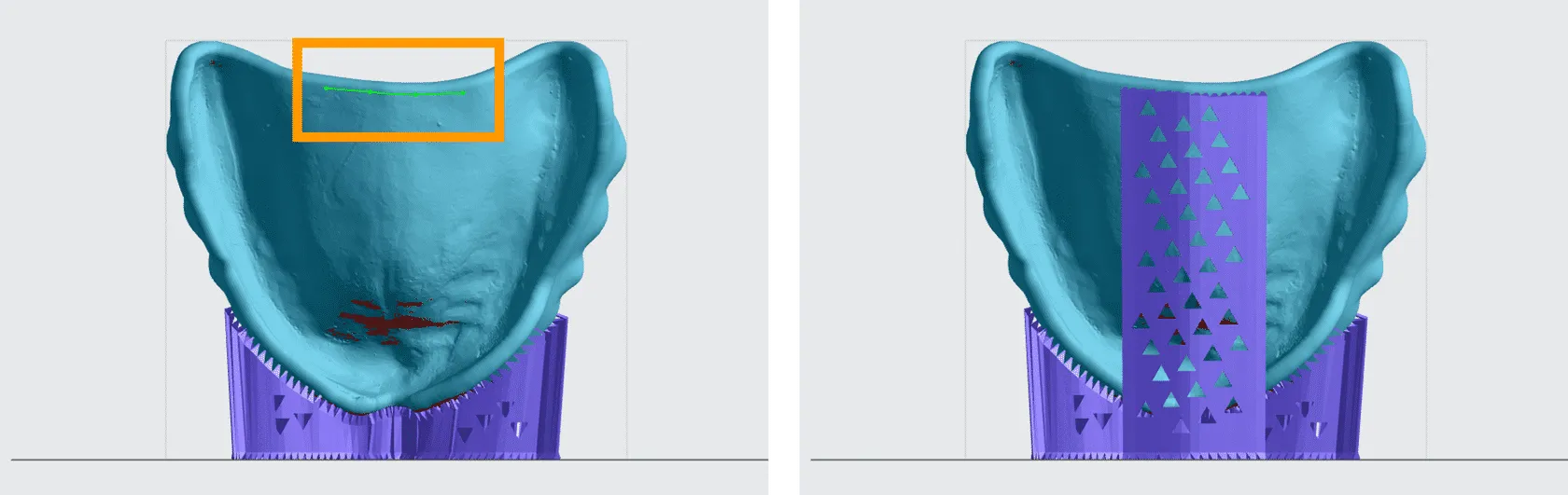 Depending on the size of the denture base, additional supports may be required. Depending on the size of the denture base, additional supports may be required.