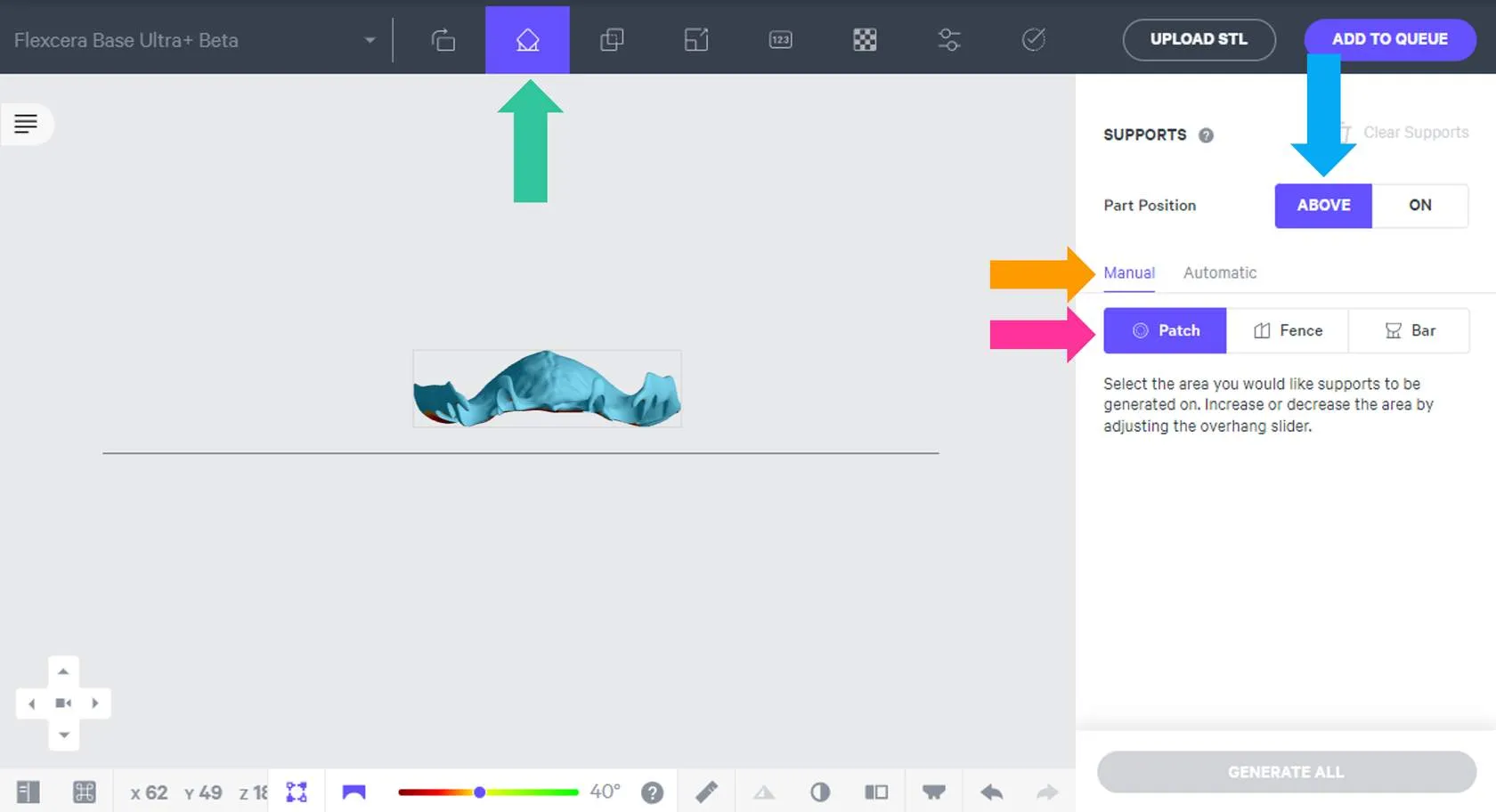 Support mode in UI Support mode in UI