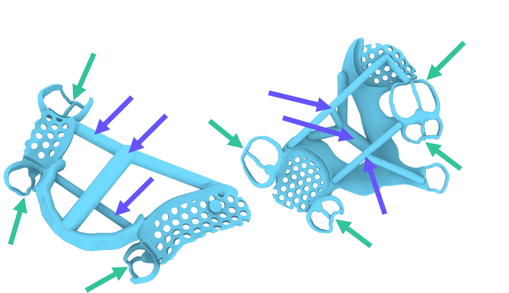Example partial denture designs Example partial denture designs
