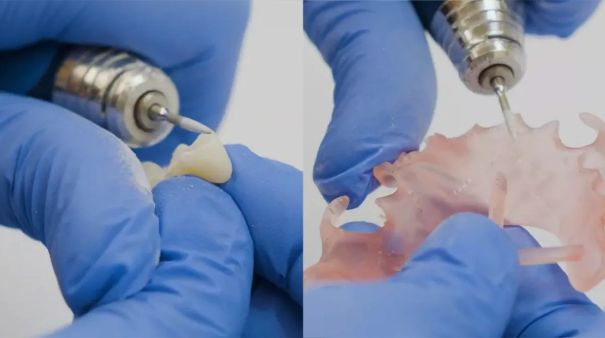Smooth teeth and base as needed